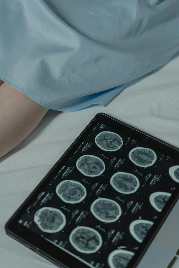 ct scan result on digital tablet